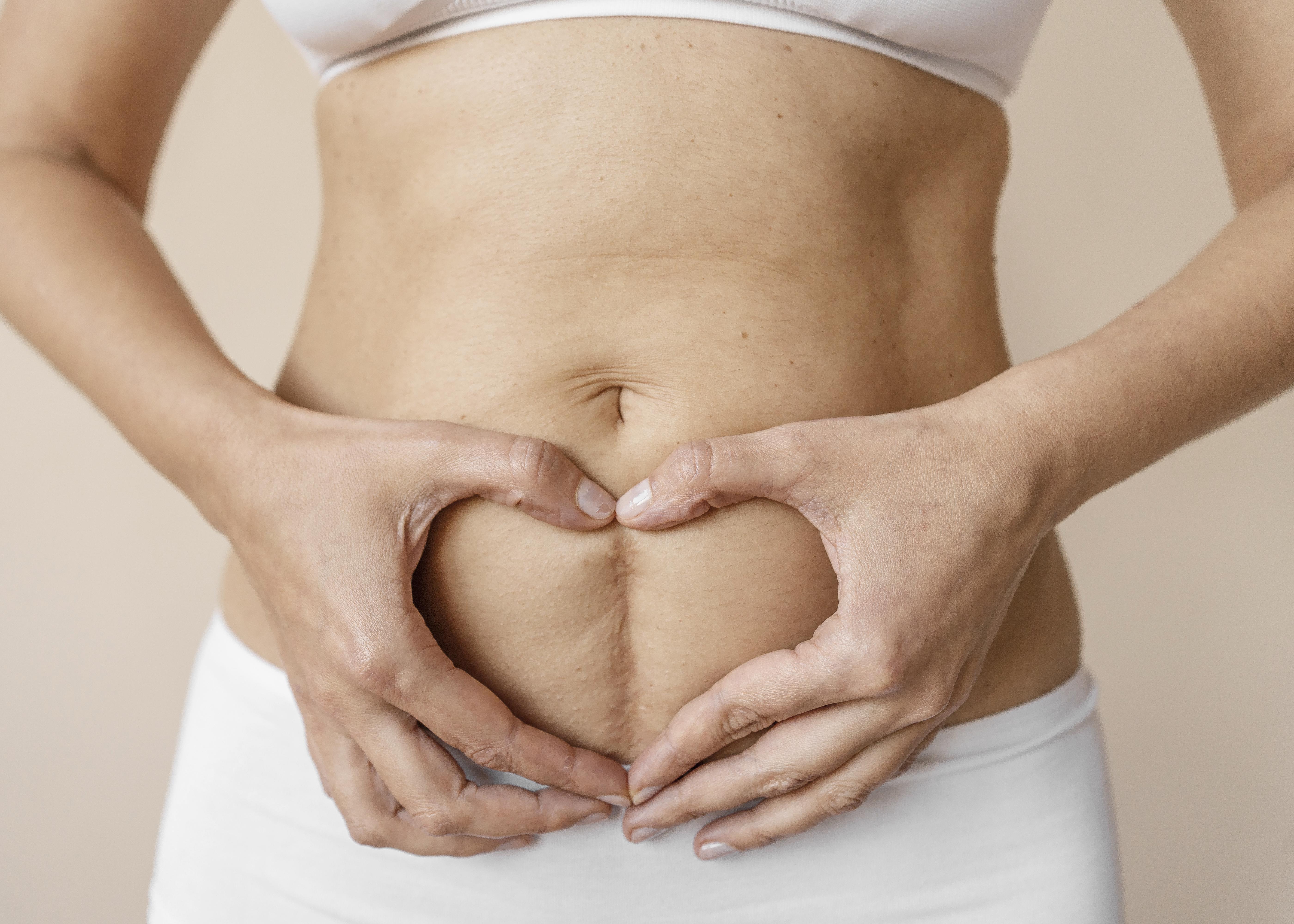 Diastasis recti condition and assessment